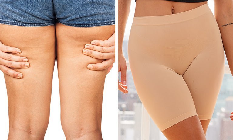 Close-up of inner-thigh chafing beside a model wearing nude anti-chafing shorts in bright studio light