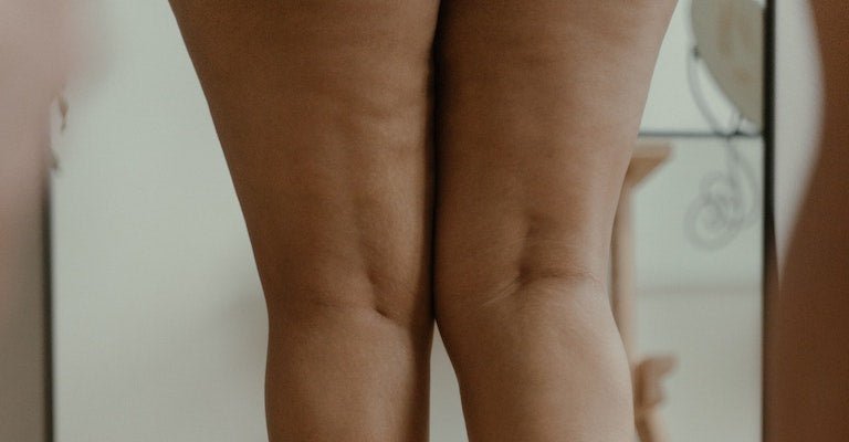 Person standing in front of a mirror showing bare thighs and knees to illustrate the inner-thigh area