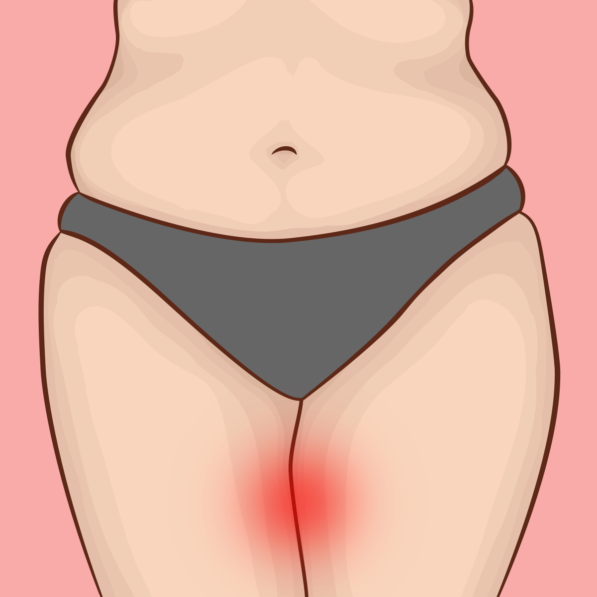Chafed thighs ruining your summer? Here’s how to care for them - Thigh Society USA Inc.